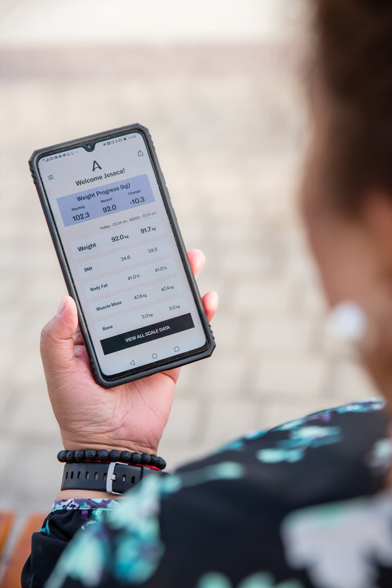 Allurion digital tracking program
